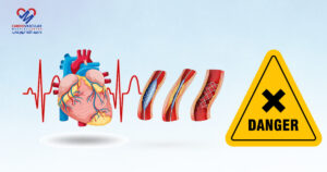أعراض بعد تركيب دعامة القلب