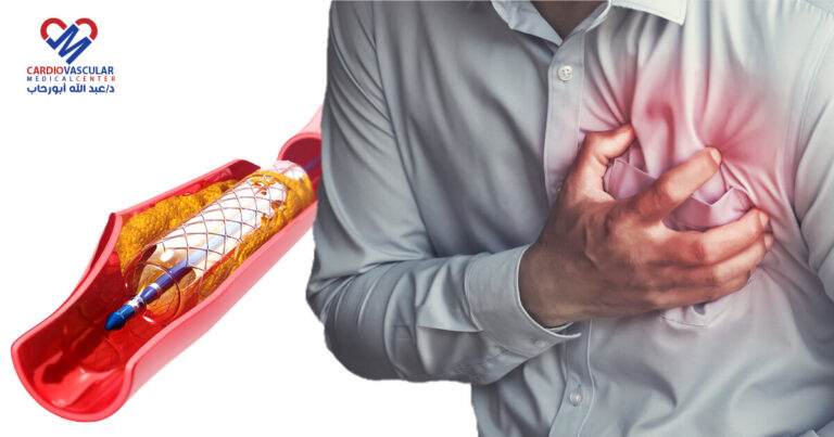 سبب الالم في الصدر وضيق التنفس بعد عملية دعامة القلب