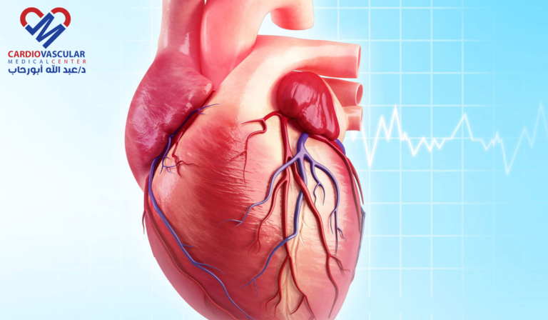 ما أسباب الجلطة القلبية؟ وكيف تحدث؟